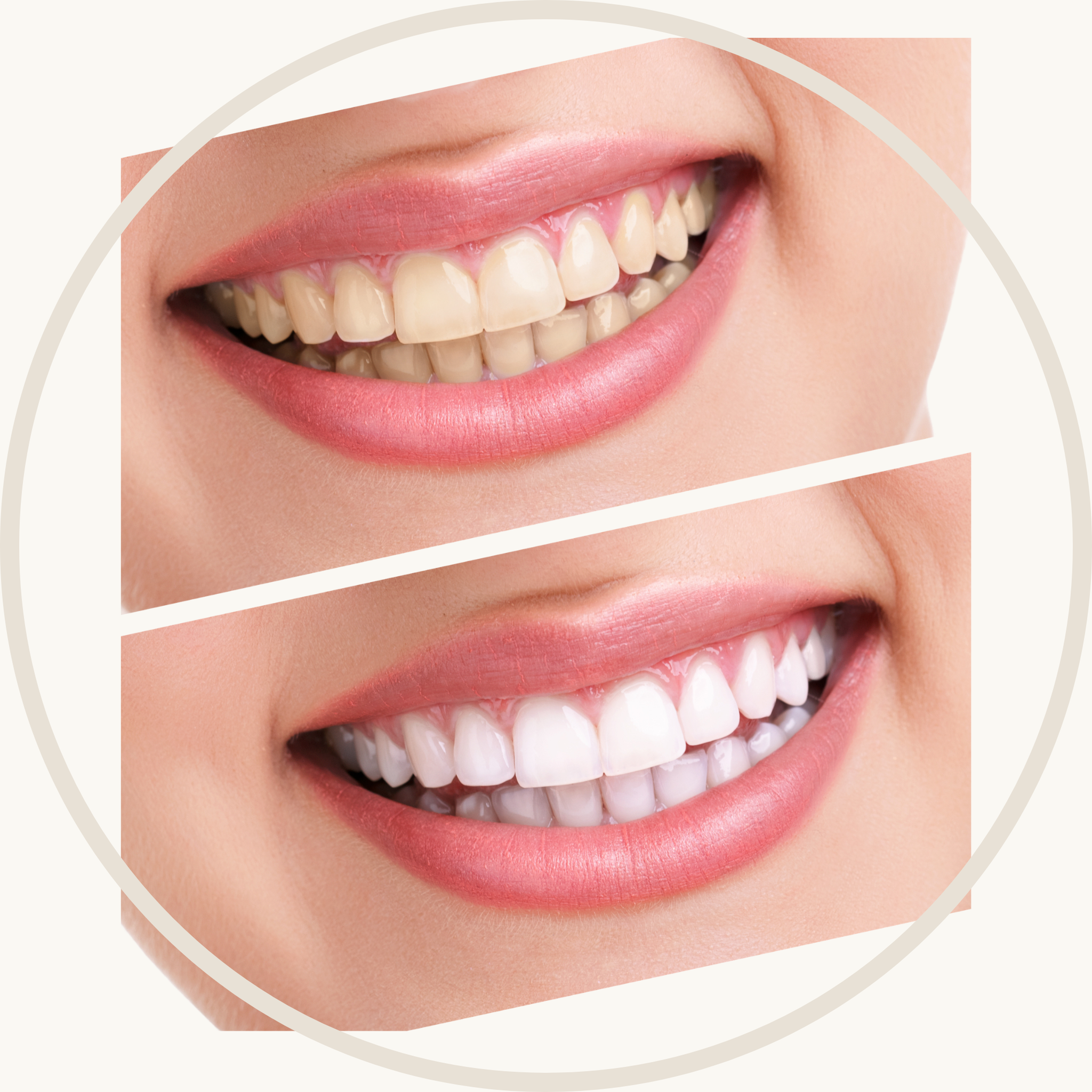 Onora_Cool_Pads_Shopify-2.png